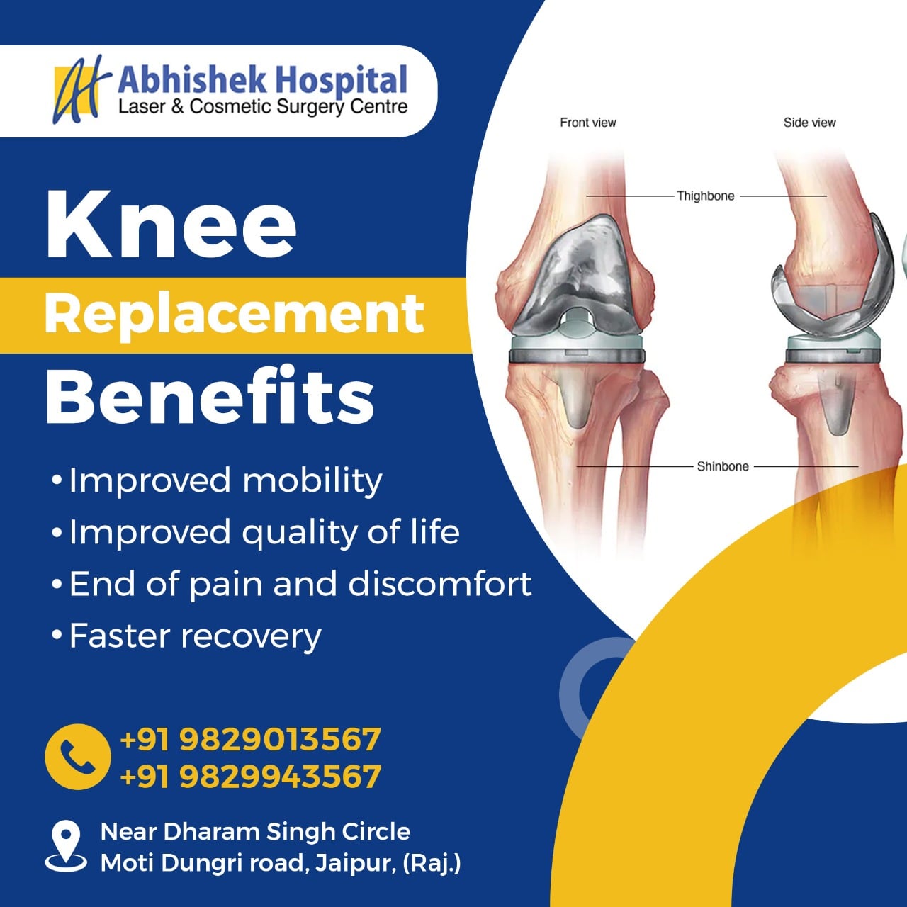 Knee Replacement Surgery