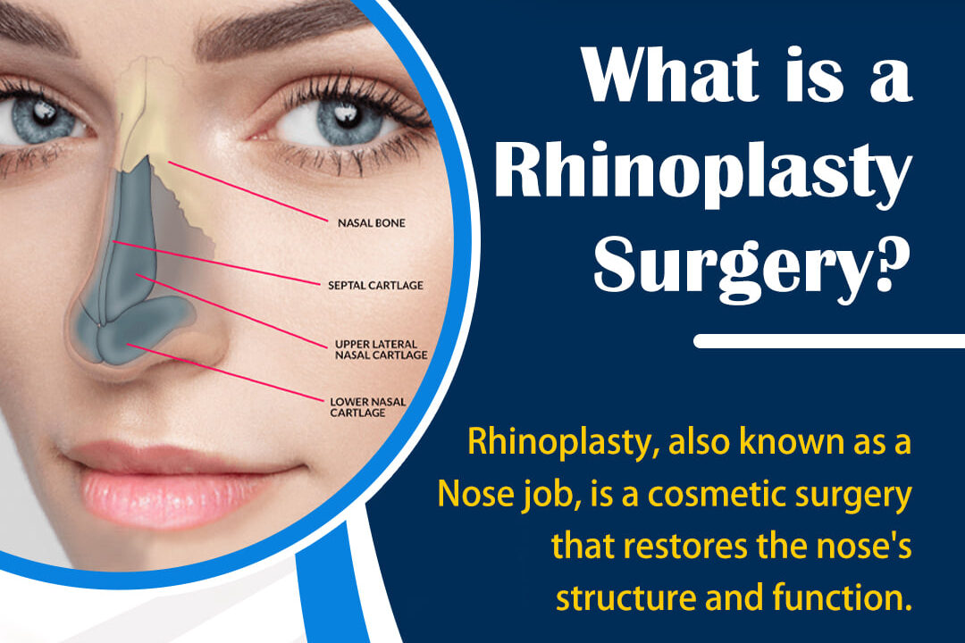 What is Rhinoplasty Surgery & It’s Benefits