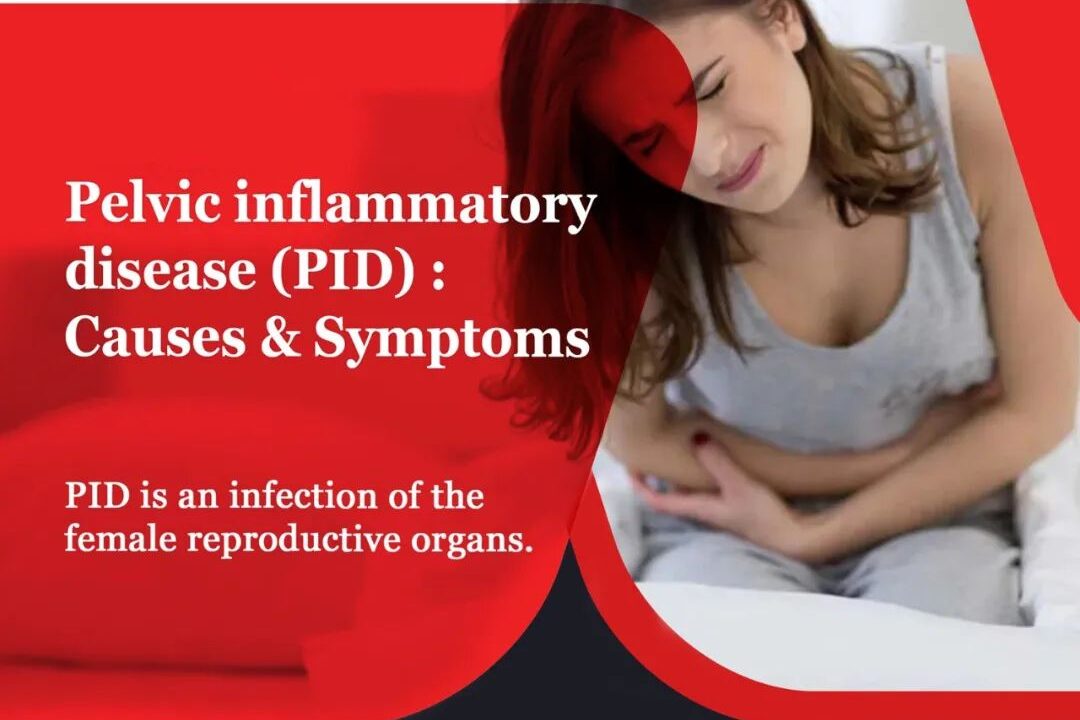 Pelvic inflammatory disease (PID) : Causes & Symptoms