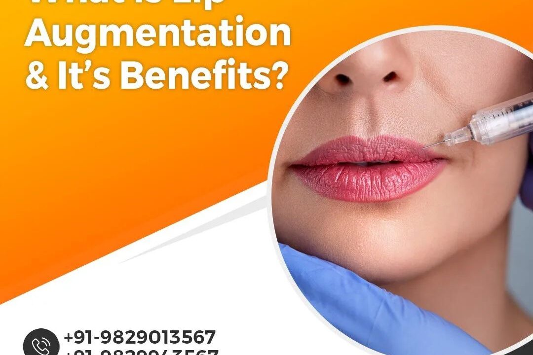 What is Lip Augmentation & It’s Benefits?