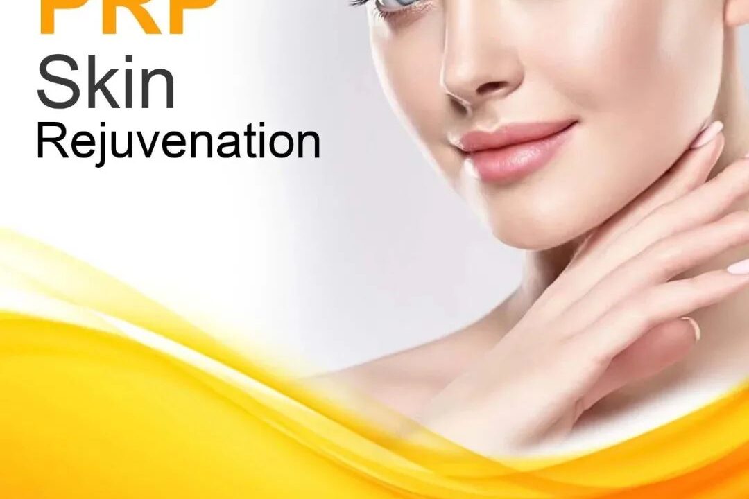 PRP SKIN REJUVENATION & Its BENEFITS