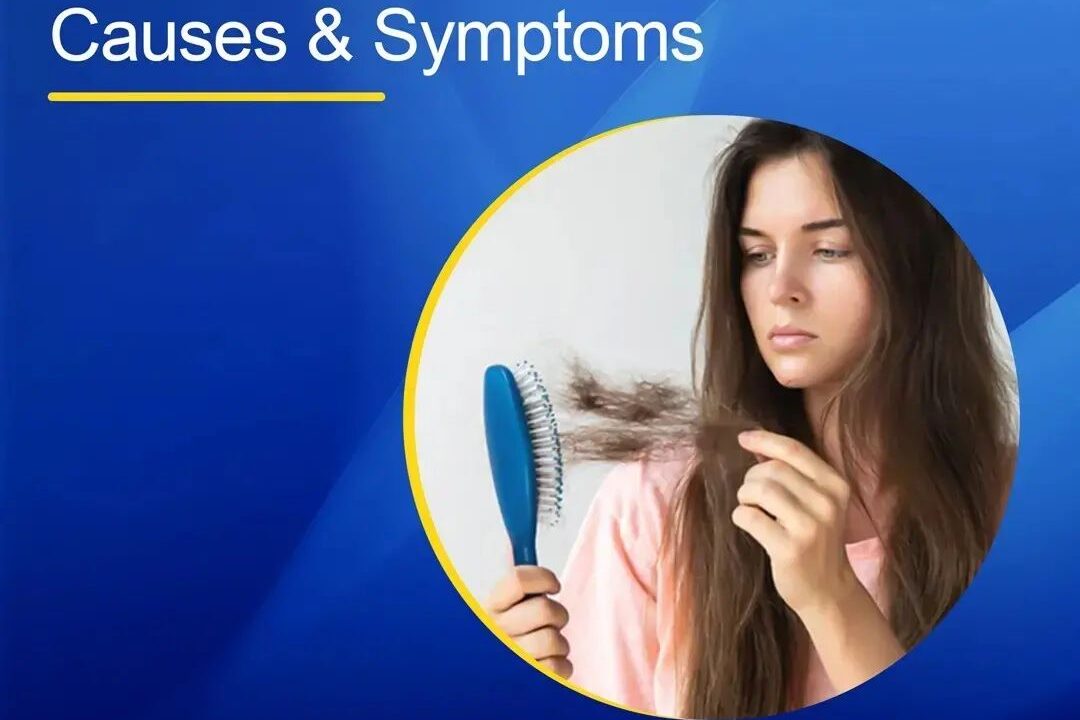 Hair Fall – Causes & Symptoms