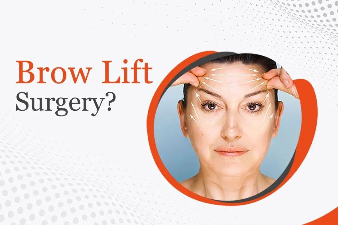 Know About Brow Lift Surgery