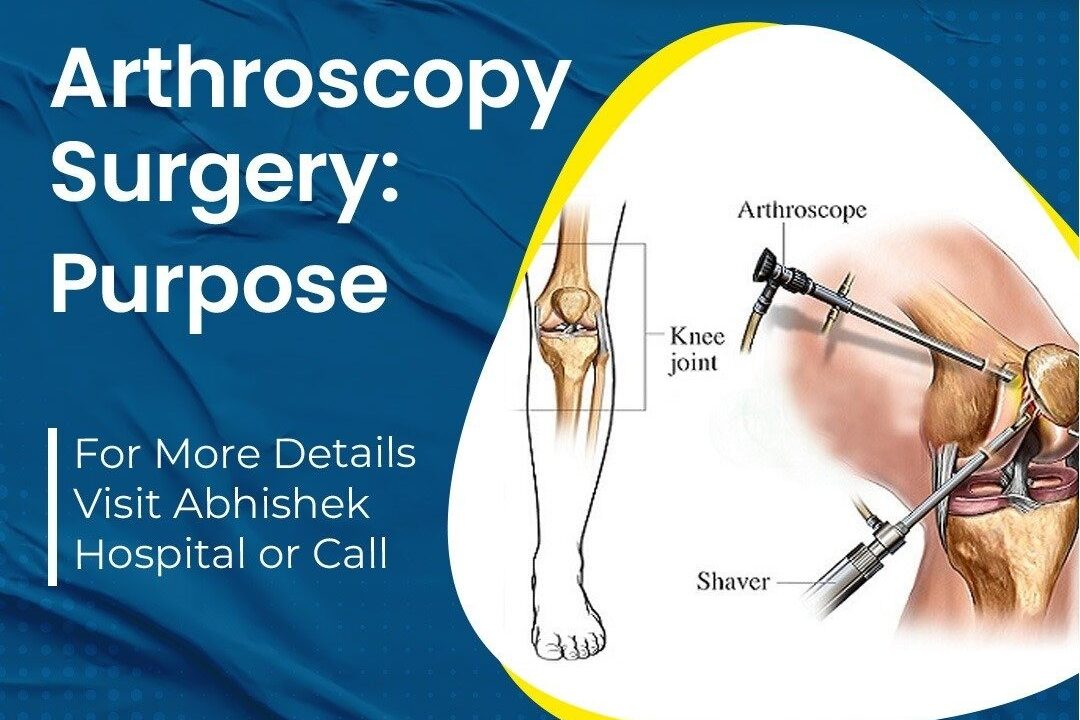 Arthroscopy Surgery: Purpose