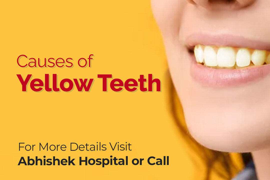 Causes of Yellow Teeth