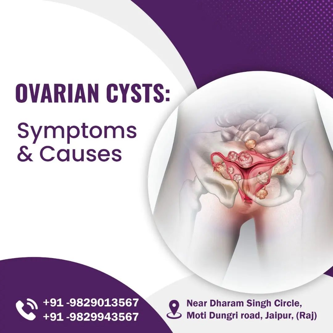 Ovarian cysts: Symptoms & Causes – Abhishek-Hospital