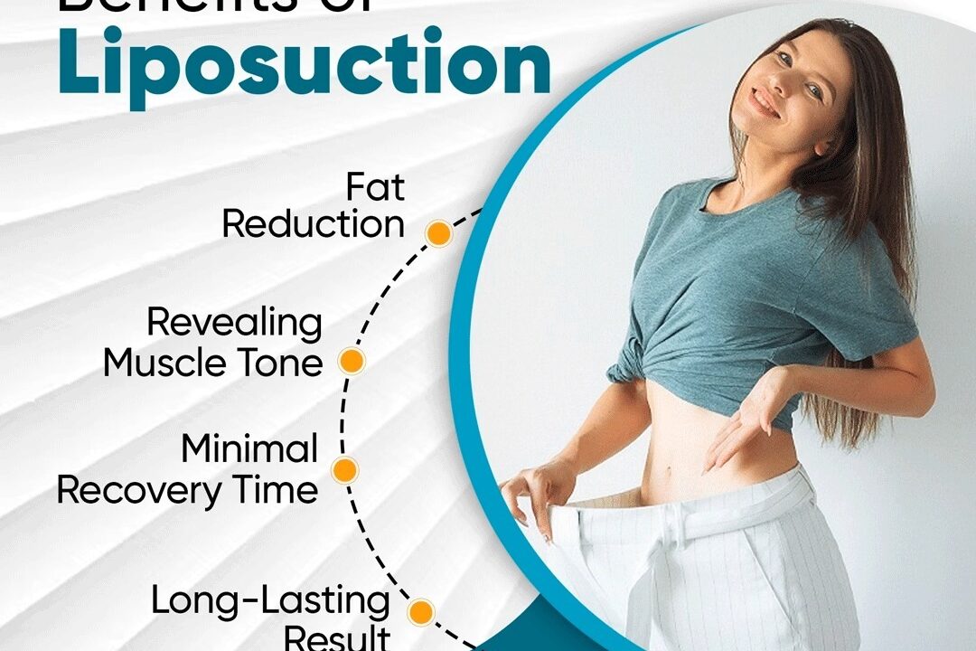 Benefits of Liposuction Surgery