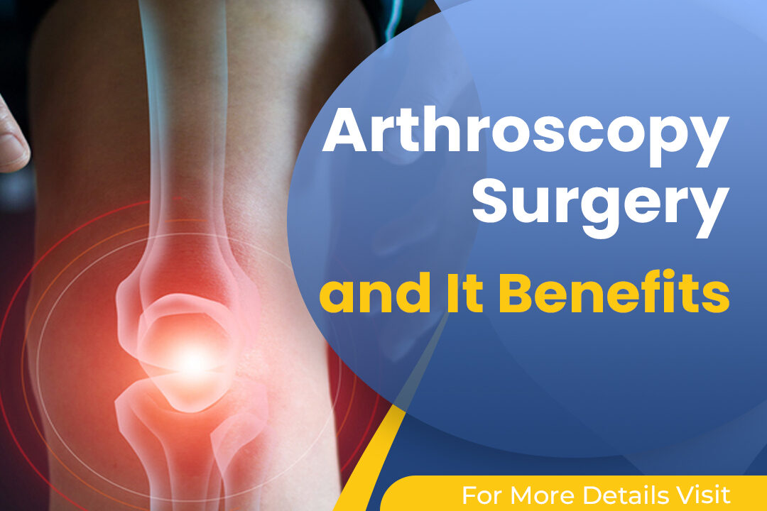 Arthroscopy Surgery And Its Benefits