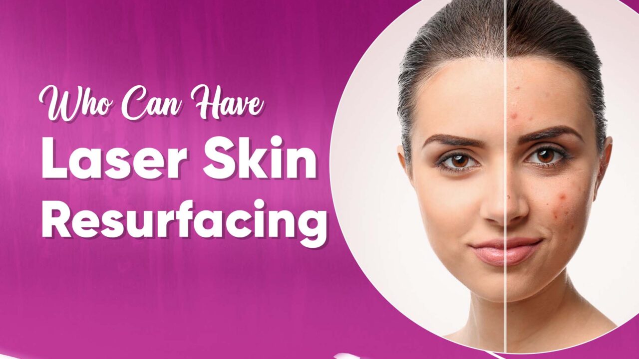 Who Can Have Laser Skin Resurfacing