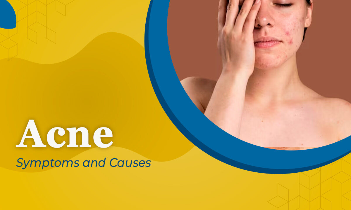 Symptoms and Causes of ACNE ?