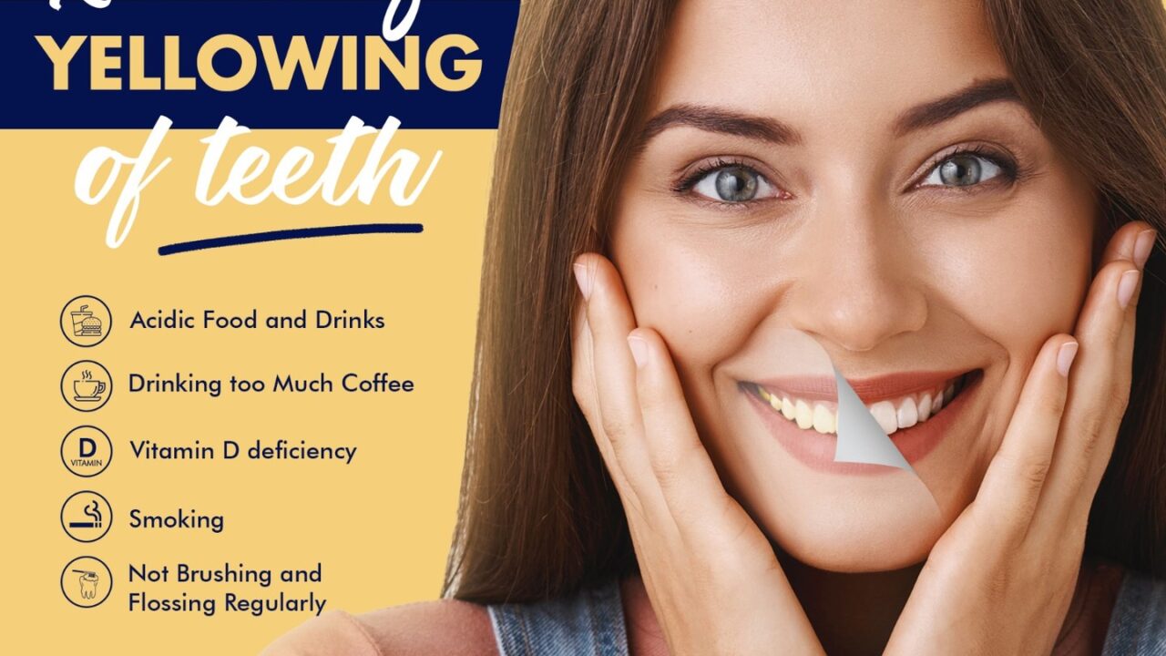 Reasons for Yellowing of Teeth