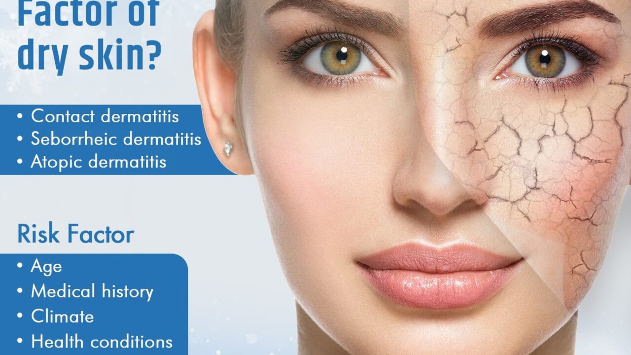 Types & Risk Factors of Dry Skin