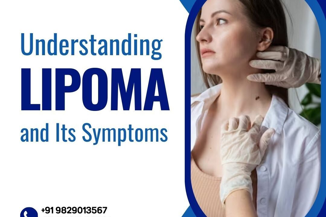 LIPOMA and Its Symptoms