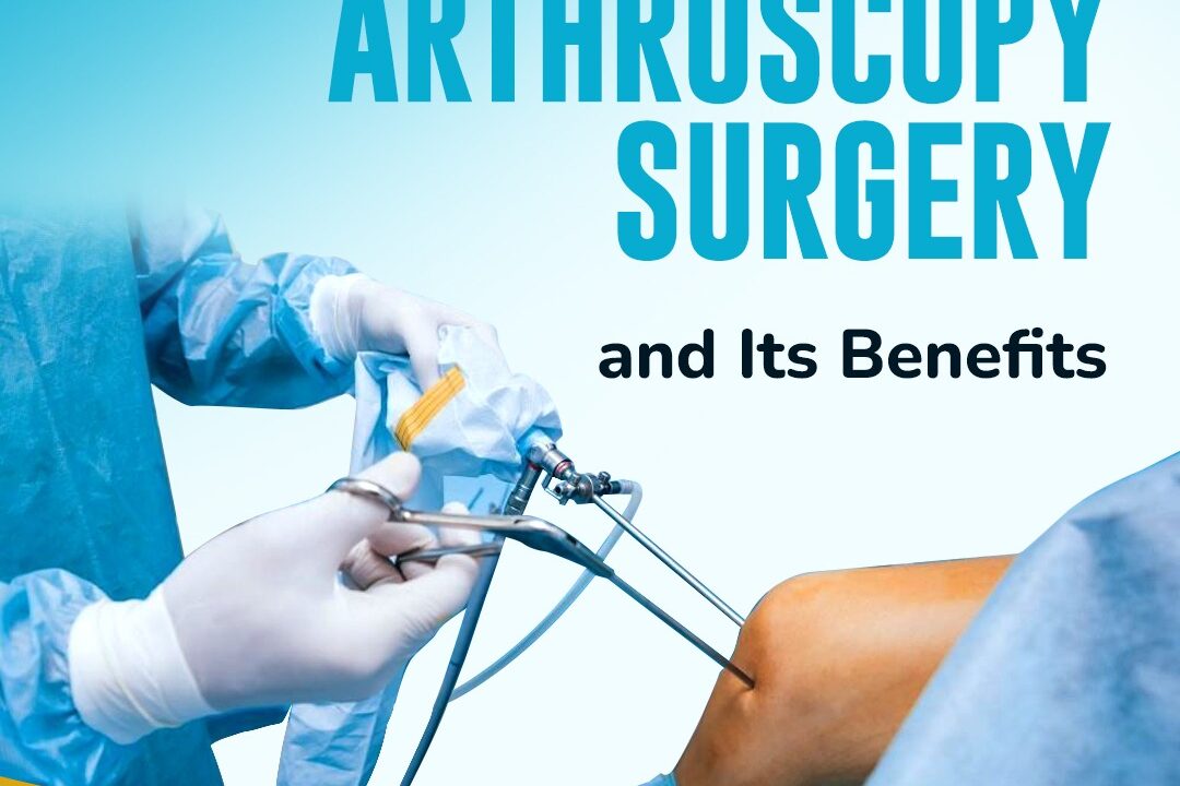 Arthroscopy Surgery – Benefits