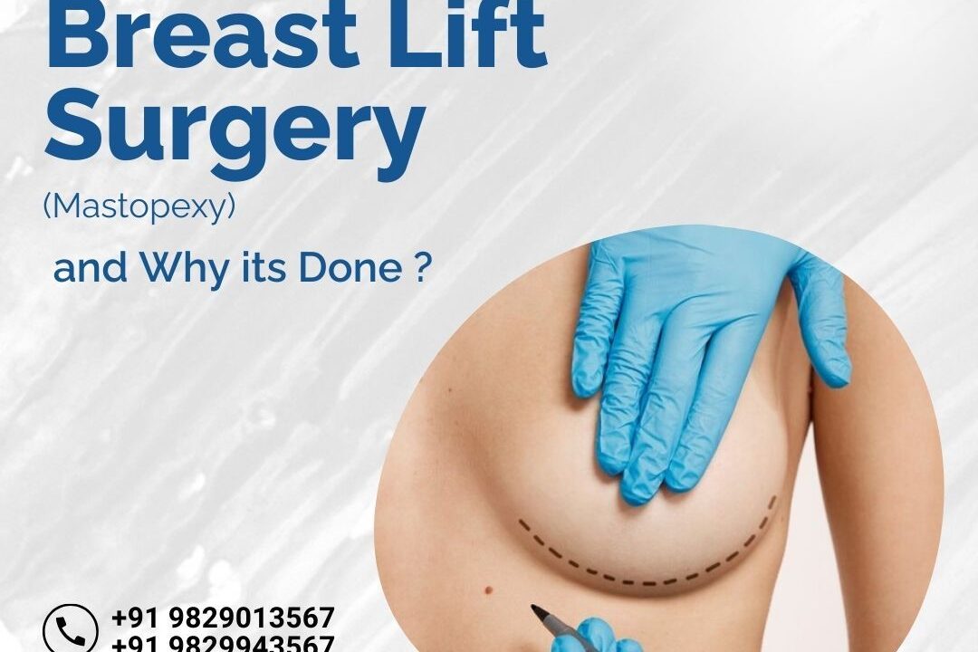 Breast Lift Surgery (Mastopexy) and Why it’s Done ?