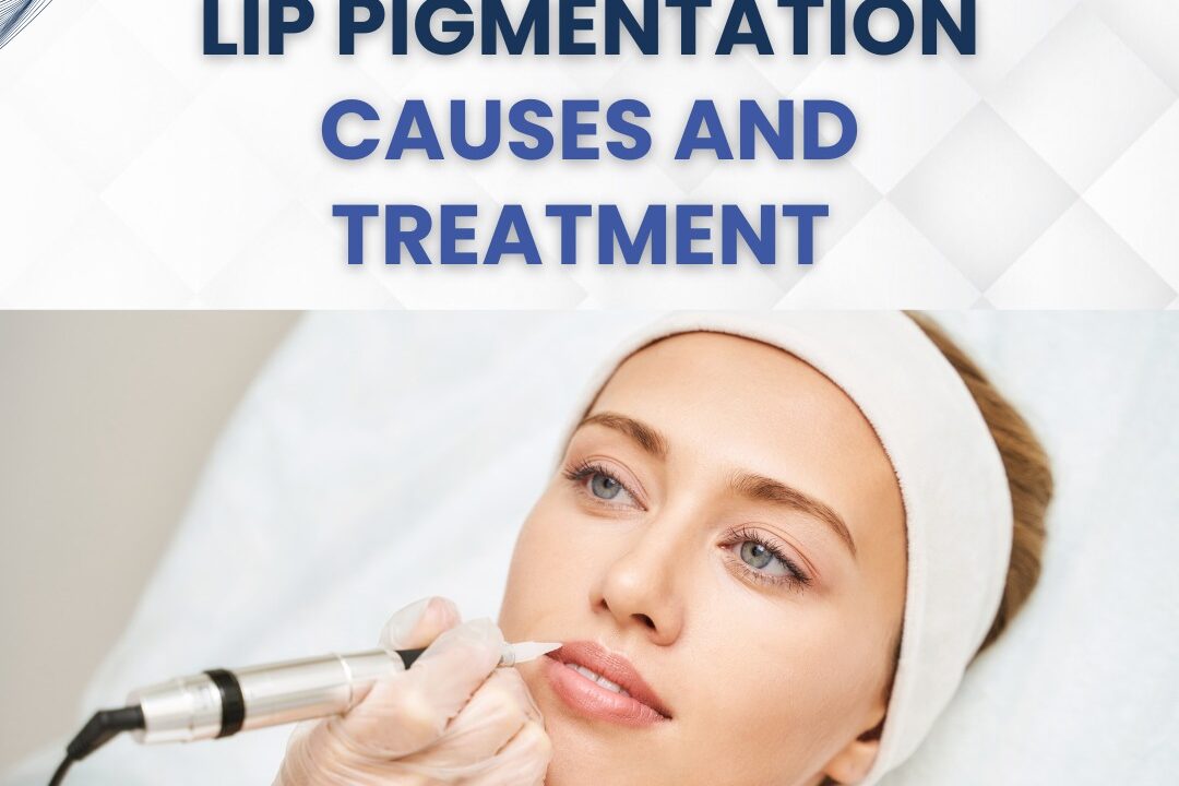 Causes & Treatments for Lip Pigmentation: