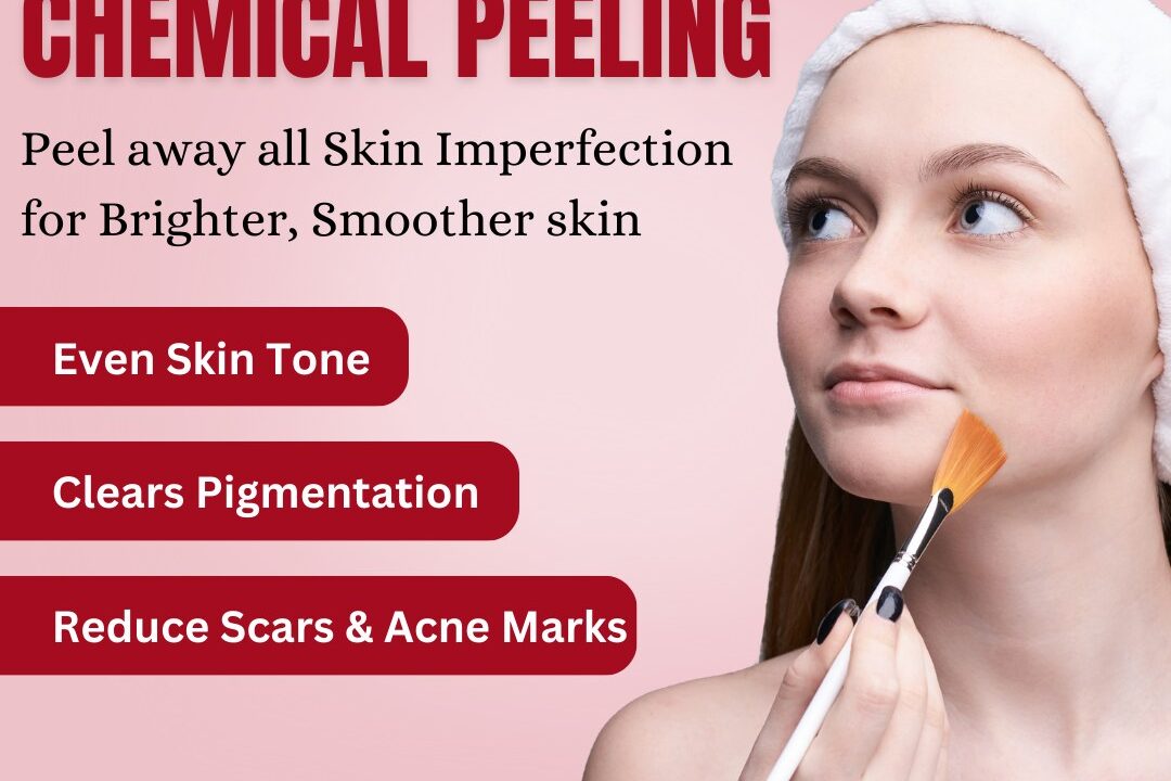 Advanced Chemical Peeling Treatment