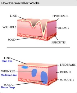 Dermal Fillers Treatment | Anti Wrinkles Treatments